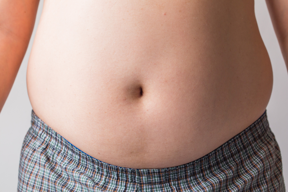 Diastasis Recti in Men - The Tummy Team